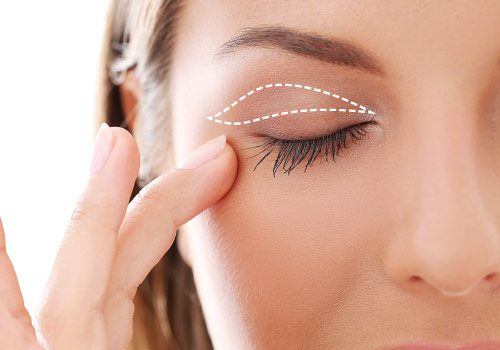 Gros plan d'une personne se touchant délicatement la paupière, les yeux fermés. Une ligne pointillée blanche souligne la forme de la paupière, suggérant une blépharoplastie ou un soin de la peau. L'image met en valeur les détails de la peau et du contour des yeux.