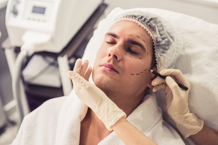 Une personne est allongée sur un lit médicalisé, les yeux fermés, coiffée d'un bonnet. Un professionnel ganté dessine méticuleusement des lignes chirurgicales sur son visage, indiquant les préparatifs d'une intervention de chirurgie esthétique masculine. La personne est confortablement enveloppée dans une serviette blanche.