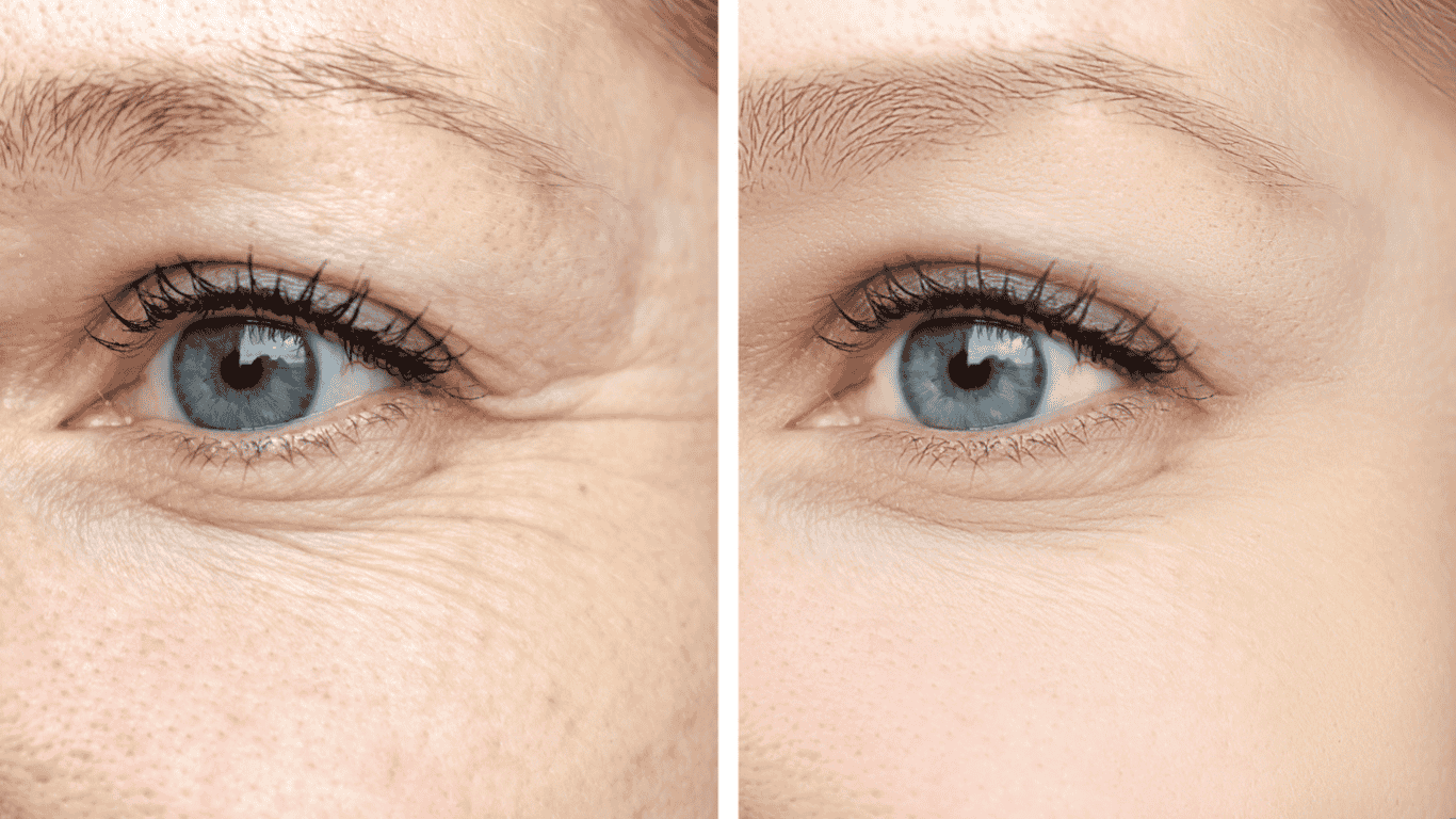 eyes