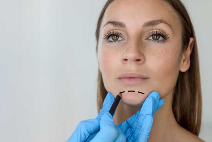 Chirurgien dessinant des lignes directrices pour le lifting du visage d'une femme avant une consultation de mini-lifting