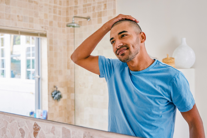 Un homme examine sa ligne capillaire dans le miroir après une greffe de cheveux.