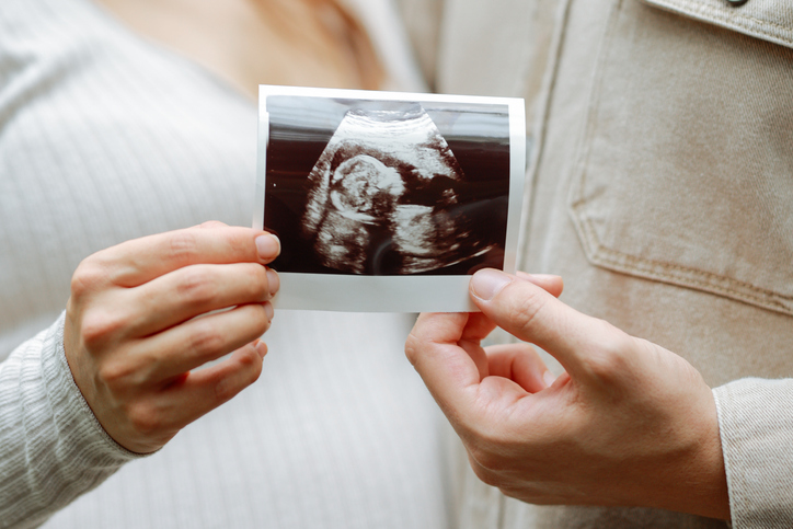 Un couple tenant une photo d'échographie, célébrant la grossesse après un traitement de FIV à la clinique Anova Fertility de Toronto